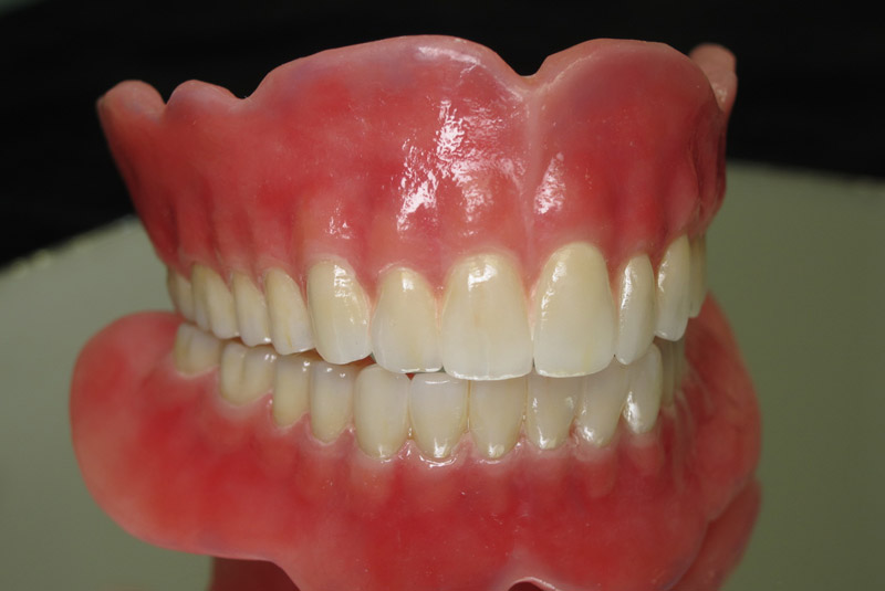 Complete Dentures Inter Pro Dental Lab Complete Dentures Inter Pro Dental Lab